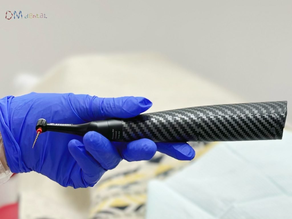 caso clinico endomotor endodoncia